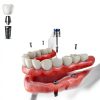 BUIFAC Dental Implant Torque Ratchet Kit 10-70Ncm Stainless Steel-2