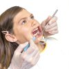 Annhua Dental Mouth Retractor Cheek Puller Disposable Set 3 Sizes-3