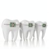 High Speed Dental Handpiece Medidenta AF90SG Ceramic Titanium-3